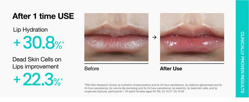 [Anua Official] PDRN Lip Serum 10ml l All day Hydrating Lip Serum, Salmon PDRN Collagen, Plumping, Long-Lasting Moisturizing, Dry Lips Treatment