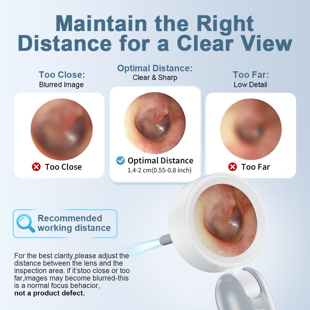 【2026 Upgrade】Aspoven Digital Otoscope with LED Light, 1.4" IPS Screen, 1080P HD Ear Scope for Kids, Adults & Pets, 12 Silicone Specula Tips, Photo & Video Recording, Type-C Rechargeable Ear Wax Removal Tool