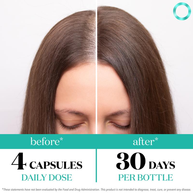 Women's Balance Hair Growth Supplements, Ages 45 and Up, Customer Proven for Visibly Thicker Hair and Scalp Coverage, Soy-Free, Made with 26 Ingredients Including Beta Carotenes