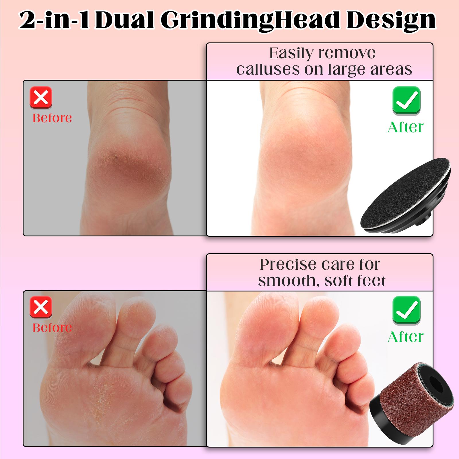 Variable Speed Foldable Electric Foot File - Automatic Callus Remover for Dead Skin on Feet, Rechargeable Pedicure Tool for Smooth Heels