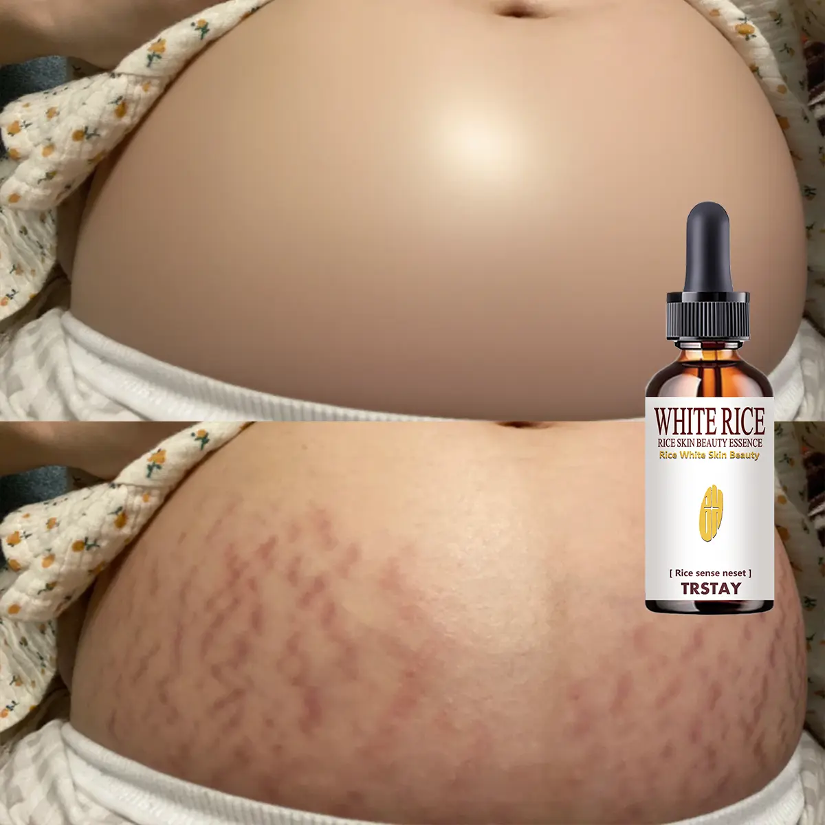 Hyaluronic Moisturizing Body Serum - Lightweight, Refreshing, Non-Greasy Skin Care for Dry Skin, Leaves Soft and Silky-Smooth, Suitable for Daily Application, Apply Daily