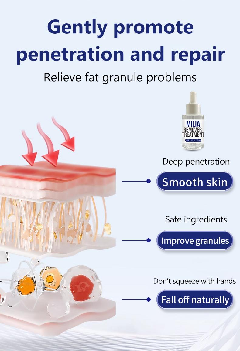 Milia Remover & Skin Repair Serum | Treatment for Radiant, Restored Skin with Hyaluronic Acid & Salicylic Acid(30ML)