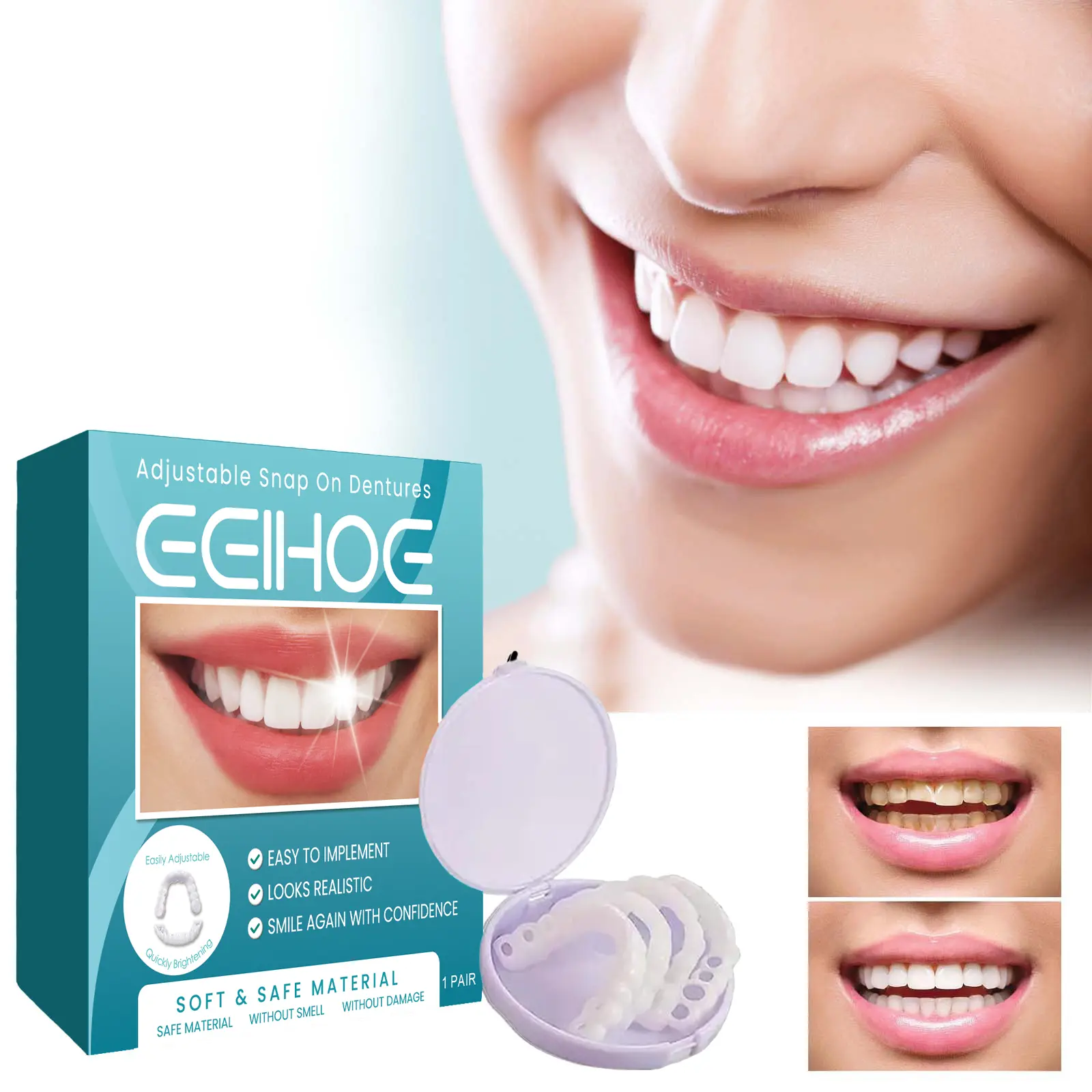 Adjustable Snap-On Denture Kit for Temporary Teeth Repair, Gap Filling, and Alignment - A Teeth Replacement Solution, Teeth Replacement Solutions