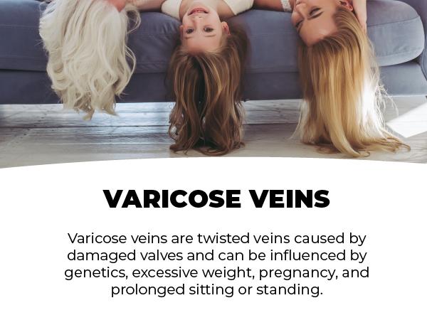 Vein Support Supplements Venease by PUREHEALTH RESEARCH - Natural Blood Circulation Supplement  - with Horse Chestnut Extract, Rutin & Buthers Broom Extract, 60 Capsules