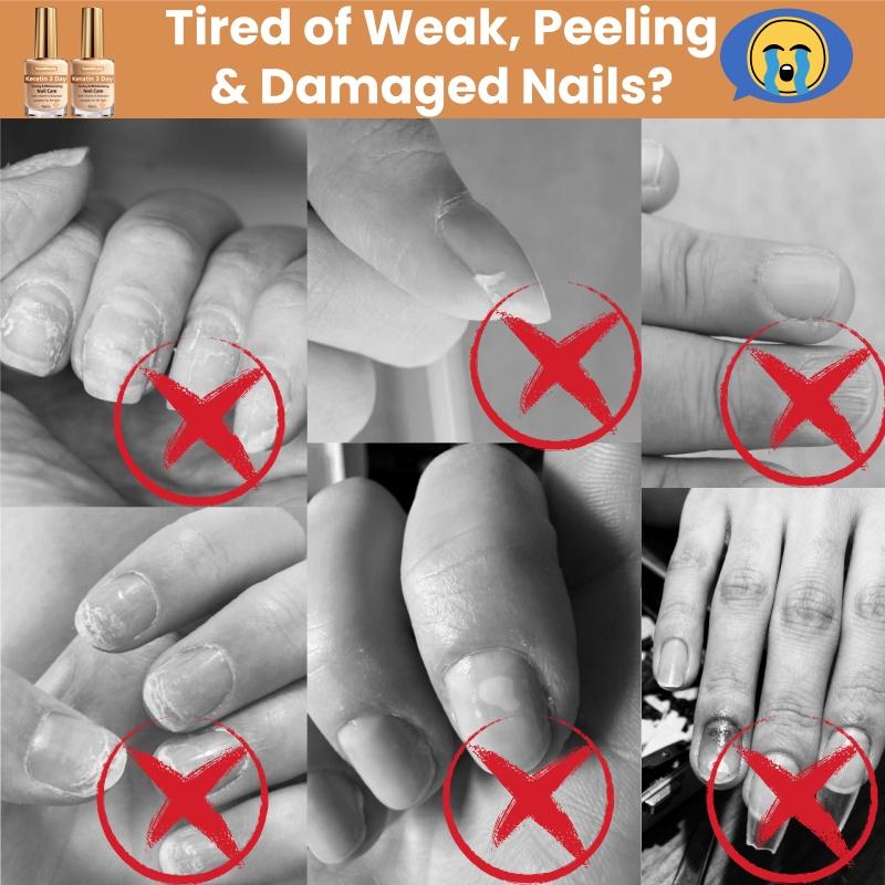 2PCS Nail Strengthener for Weak, Splitting, Breaking Nails - Fast Dry Keratin & Natural Protein Hardener, 4-in-1 Nail Polish Care Oil, Alcohol-Free Formula for Instant & 3-Day Nail, Manicure for Hands & Fingers