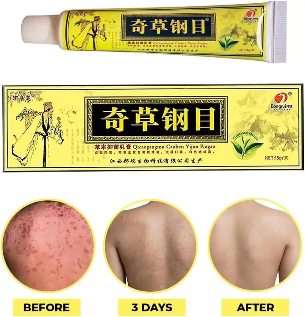 Cream Psoriasis Eczema Treatment Dermatitis Skin for Body Relief Natural Care