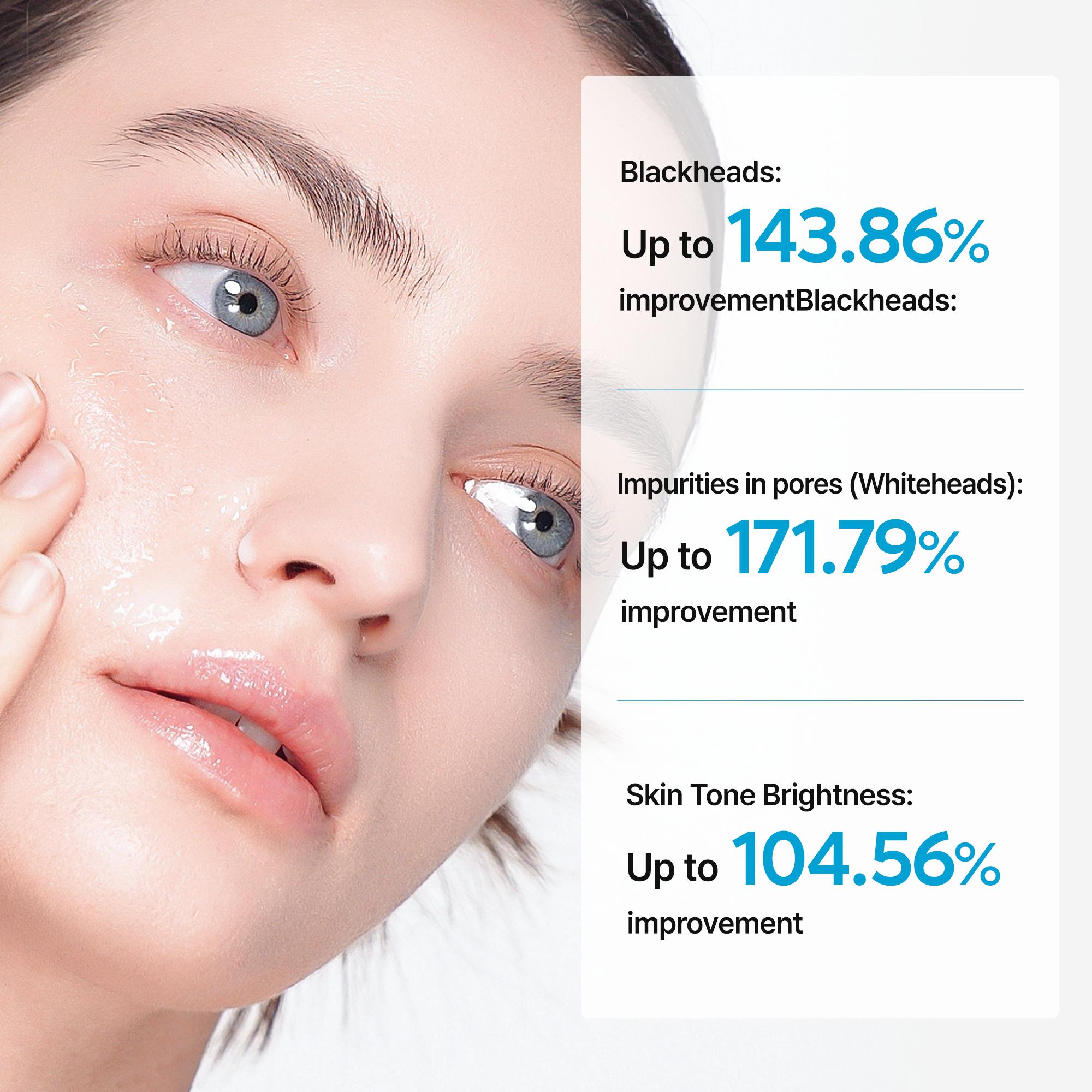 [Dr.Melaxin Official] Peel Shot Exfoliating TX-Serum 80ml, Tranexamic Acid & Niacinamide Gentle Peeling for Dark Spot Care