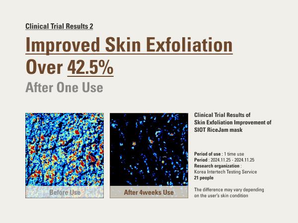 SIOT Rice Jam Mask 8.45oz | Korean Rice Hydrating Wash-Off Face & Body Mask with Gentle Exfoliating, Daily Moisture Care for Smooth, Soft Skin