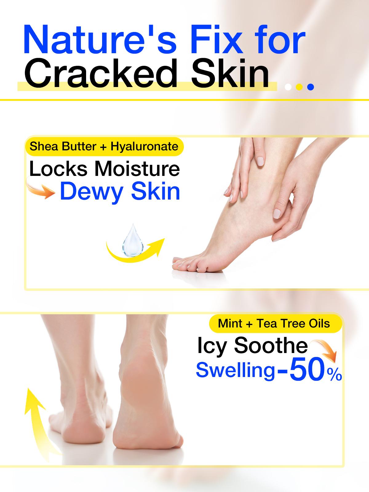 FOOT RESCUE - Advanced Restorative Treatment - Urea Foot Repair Cream - Salicylic Acid Foot Ointment