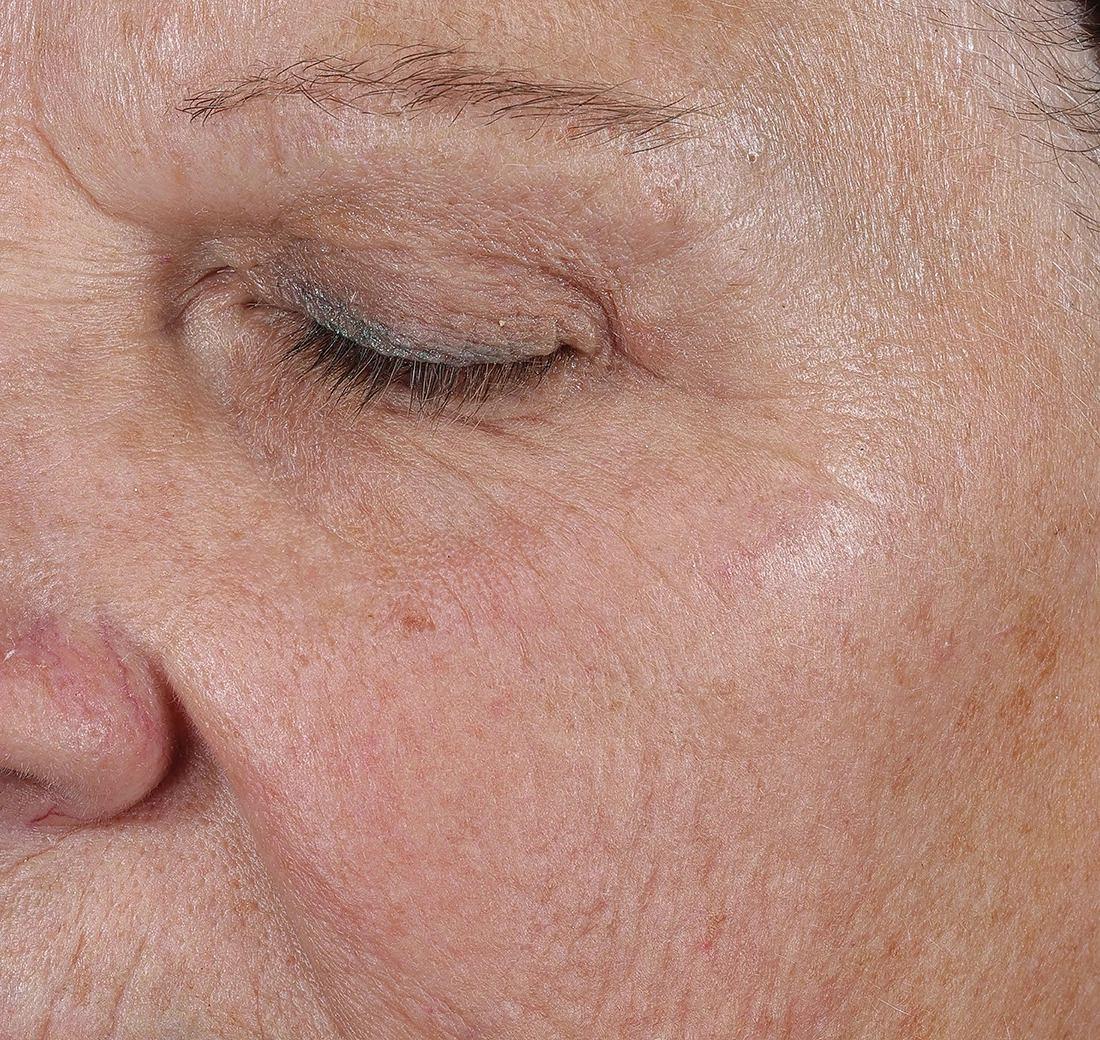 Obagi Medical ELASTIderm Lift & Sculpt Facial Moisturizer – lifts, firms, and hydrates with Bi-Mineral Complex