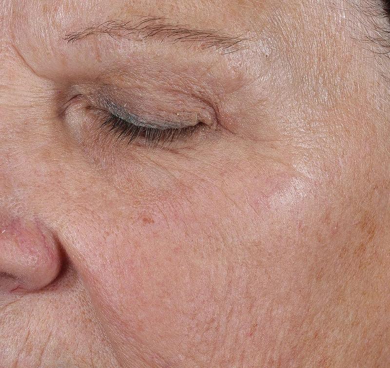 Obagi Medical ELASTIderm Lift & Sculpt Facial Moisturizer – lifts, firms, and hydrates with Bi-Mineral Complex