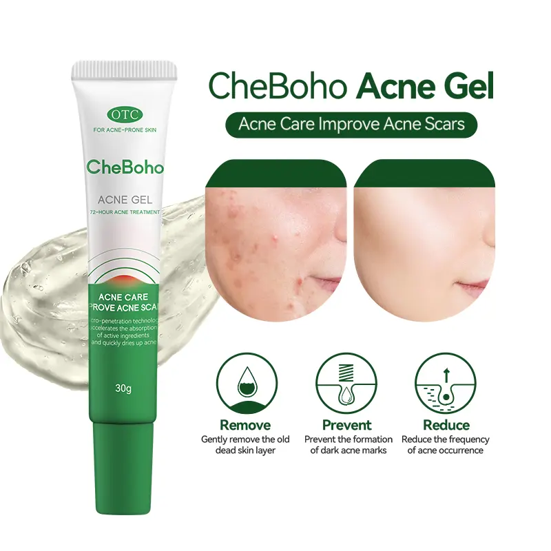CheBoho Acne Scar Treatment Cream 30ml & Cream Post-Acne &Pimple Treatment Fragrance Free ParabenFree Skincare Tea Tree Oil Skin Repair Sensitive Teensfree Skincare