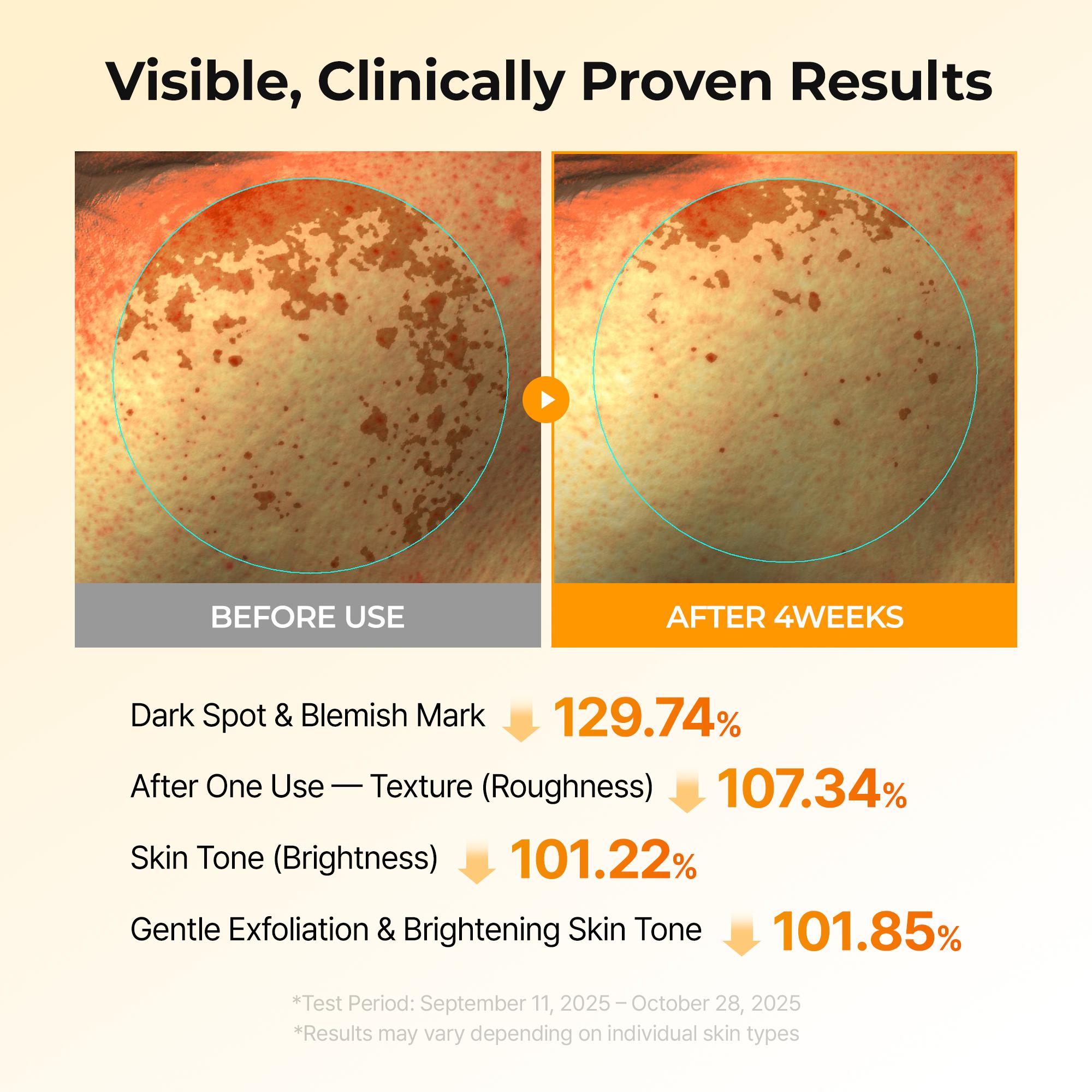 [Dr.Melaxin Official] Kojic Acid Turmeric TX Toner Pad 70pads, Dark Spot & Pigmentation Care for Uneven Skin Tone