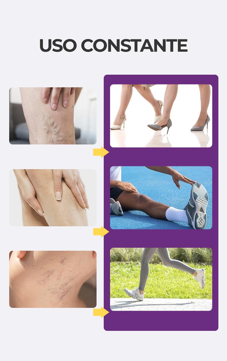 【Buy 1 Get 1 Free】Kreain Nature 4 Varicose Vein Treatment Cream Nature Ingredients Relieve Leg Pressure Centella Asiatica Root Extract dealsforyoudays