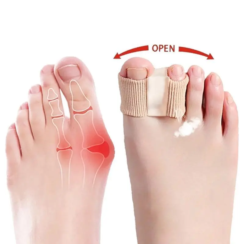 [2-Pack]Bunion Reliever Comfortable and durable Bunion Support for Walking, Running, Hiking Shoes Breathable Toe Corrector Orthopedic Toe Straightener, Acrylic, Double Set, Two-Packs