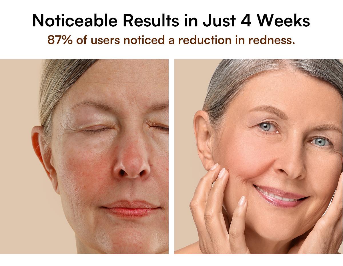 INIA GLOW 2 Red Light Therapy Mask , 4 Light Modes with 850nm NIR, 2600mAh Rechargeable LED Face Mask for Skincare at Home and Travel, Best Valentine's Day Gift for Her