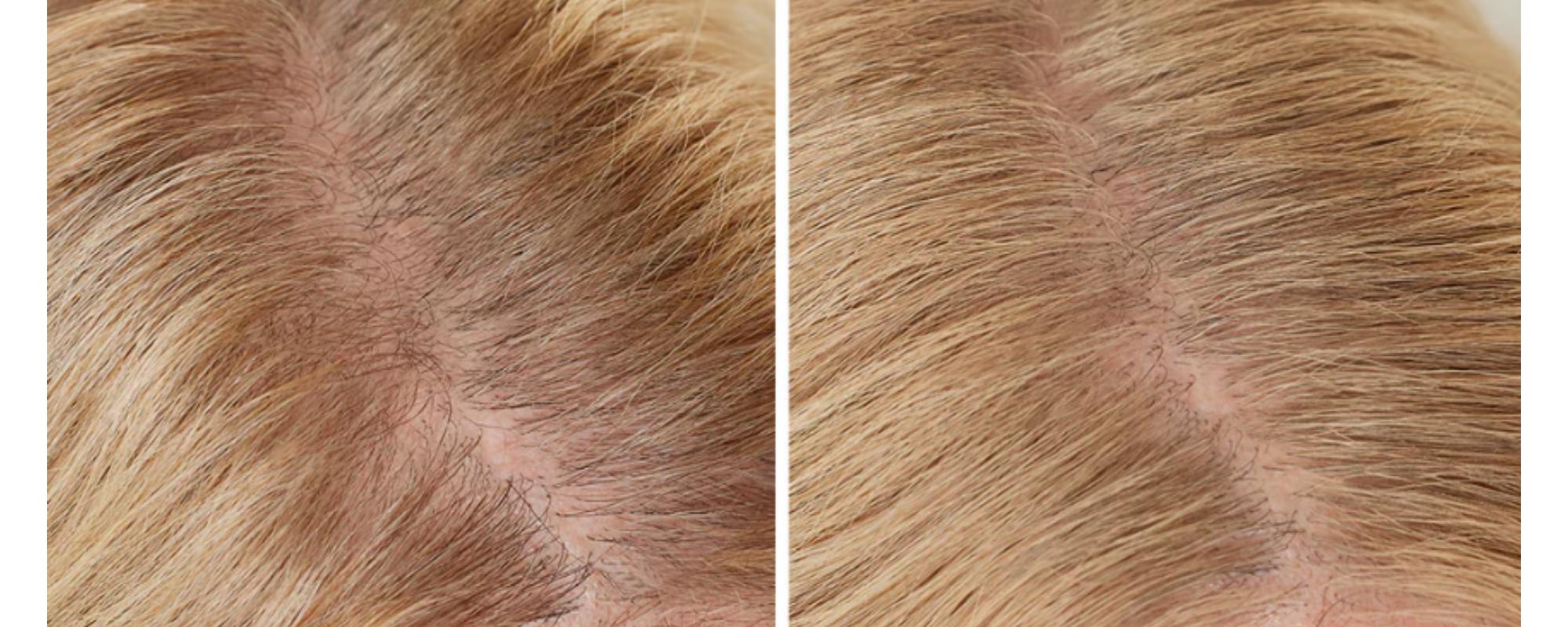 Buy One Get one Free Hairline Powder