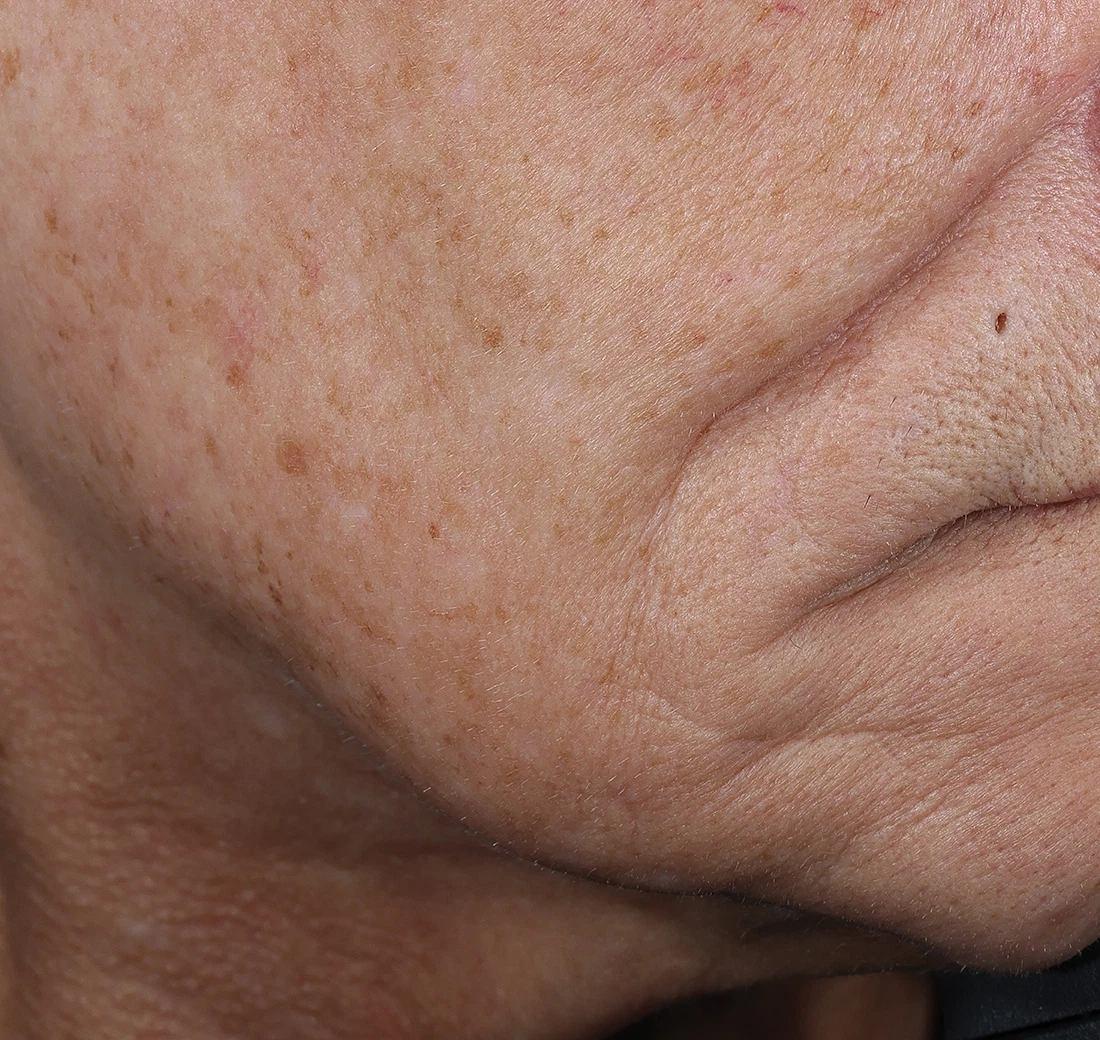 Obagi Medical ELASTIderm Lift & Sculpt Facial Moisturizer – lifts, firms, and hydrates with Bi-Mineral Complex Obagi Medical ELASTIderm Lift & Sculpt Facial Moisturizer – lifts, firms, and hydrates with Bi-Mineral Complex