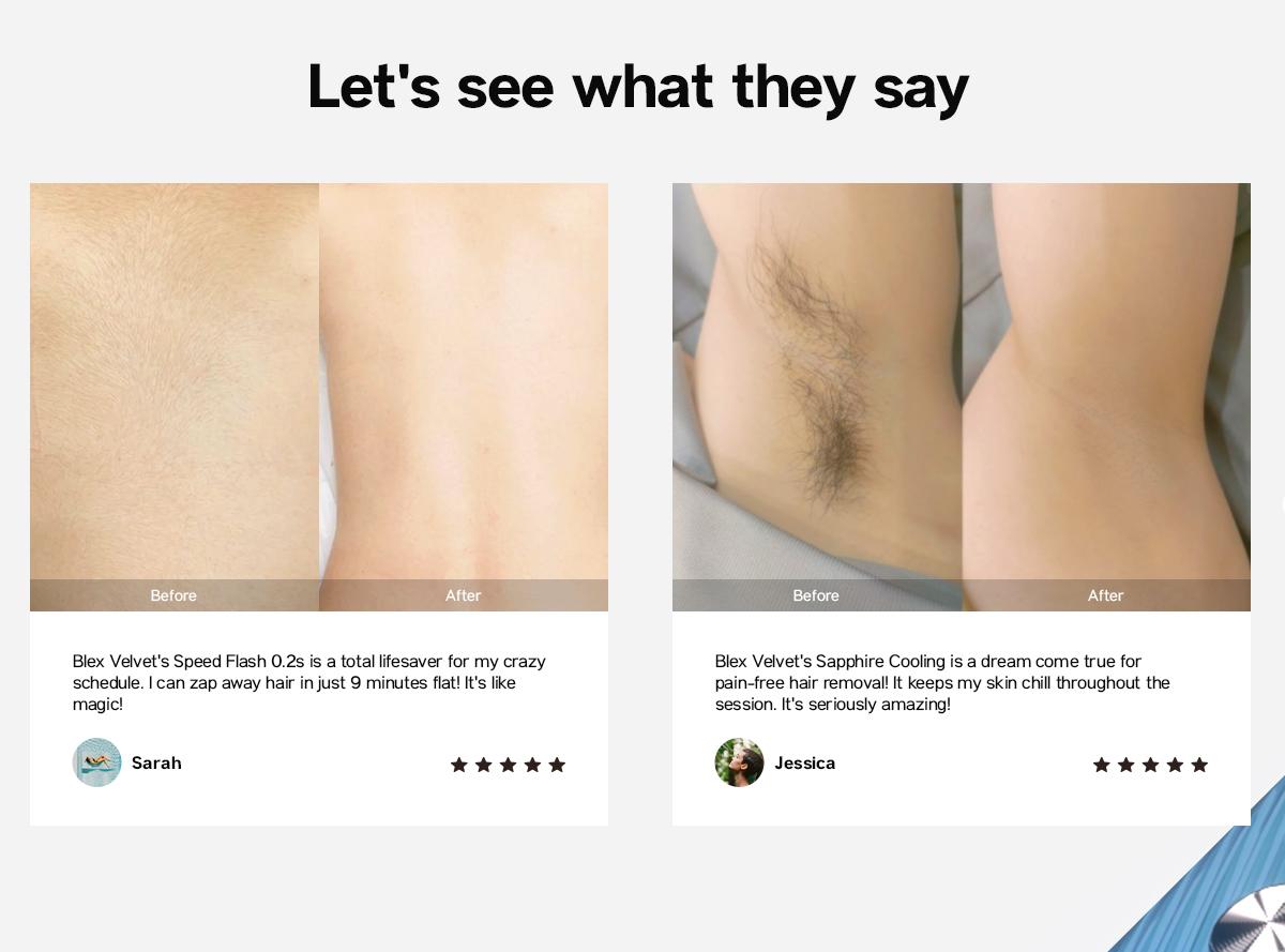 Blex Laser Hair Removal for Women and Men, Blex Velvet IPL Hair Removal Device with Sapphire Ice-Cooling Design, Dual-Pulse Technology & 0.2 Seconds Flash Gap, Nearly Painless & Lasting Result for Body & Face