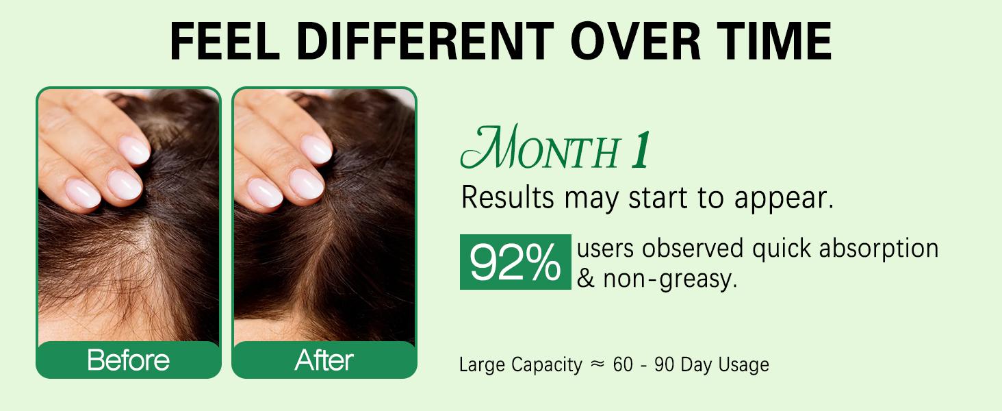 Rice Water Rosemary Spray - Rosemary & Rice Water Spray For Women & Men, Dry, Weak Hair, Thickening Haircare Organic