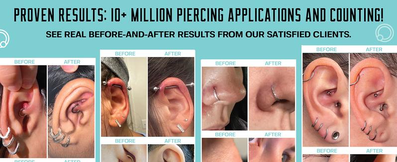Base Laboratory Piercing Aftercare Spray - Saline Spray for Piercings For Piercing & Keloid Bump Removal for Ears, Bell Wound Healing Base Laboratory Piercing Aftercare Spray - Saline Spray for Piercings For Piercing & Keloid Bump Removal for Ears, Bell Wound Healing