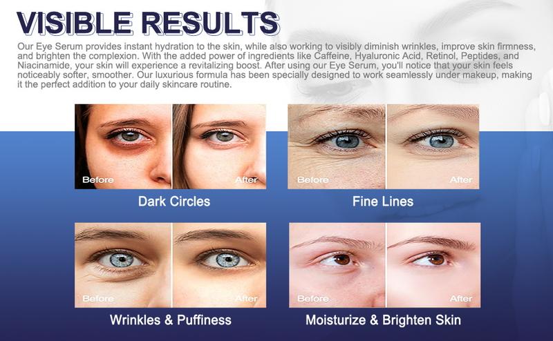 POEROES  Caffeine Eye Serum and Eye Cream Roller Eliminates Dark Circles and Puffiness, Reduces Wrinkles and Fine Lines, and Eliminates Puffiness 360°Massage Ball for a Comfortable Skincare Experience