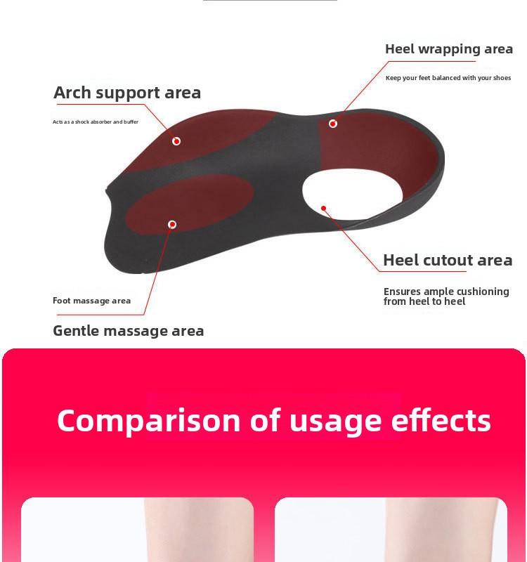 Flat Foot Orthopedic Insoles|   Correct Overpronation/Supination, X/O Leg Deformities & Toe Gait