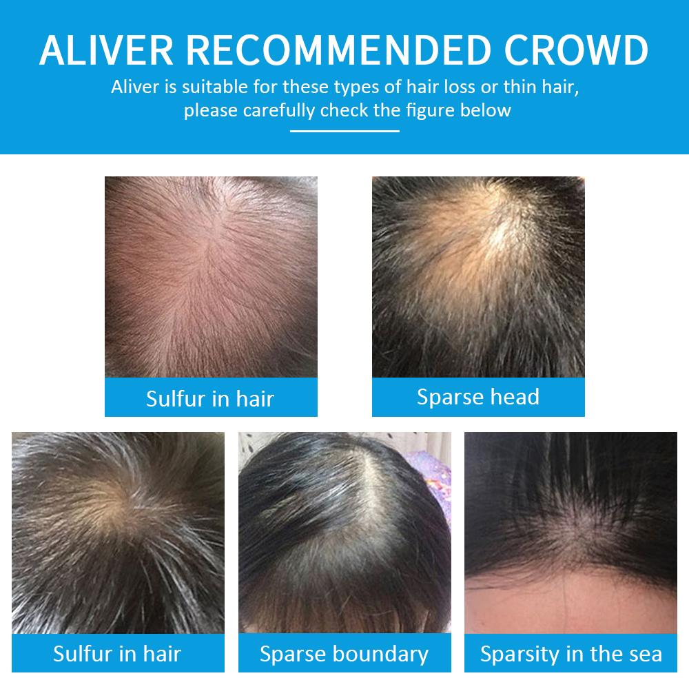 Aliver  Hair Building Fibers- for Thinning Hair，for Man and Wome Sweatproof n Powder No Stains Covering Haircare