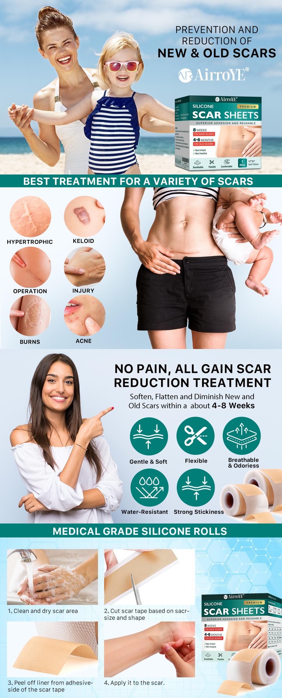 AirroYE Premium Silicone Scar Sheets 1.6"x120" Roll-3M Reusable Effective Removal for Surgical Scars Healing Keloids C-Section Tummy Tuck Non Irritant Flexible Breathable Comfortable Scar Treatment AirroYE Premium Silicone Scar Sheets 1.6"x120" Roll-3M Reusable Effective Removal for Surgical Scars Healing Keloids C-Section Tummy Tuck Non Irritant Flexible Breathable Comfortable Scar Treatment