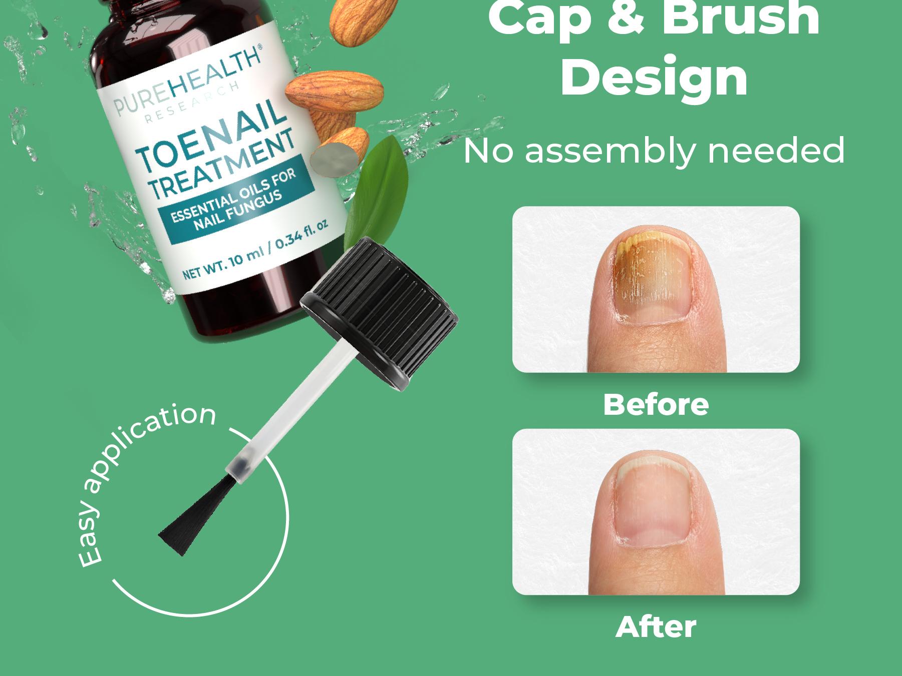 Toenail Wellness Oil by PUREHEALTH RESEARCH - Unlock Foot Care & Nail Health with Toenail Oil for Growth and Strength with Tea Tree Oil & Oregano Oil - Expert Nail Repair & Nail Care for Damaged Nails - 1 Bottle, 0.34 fl Blend Clear