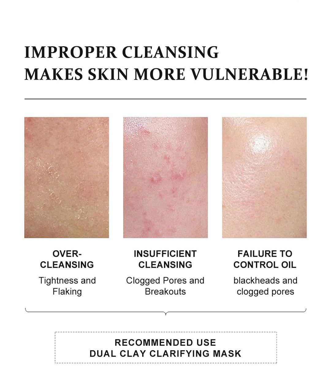 YCZ Purifying Two-Color Cleansing Mud Mask - Dual Clay Face Mask for Deep Pore Detox Oil Control & Hydrating Glow