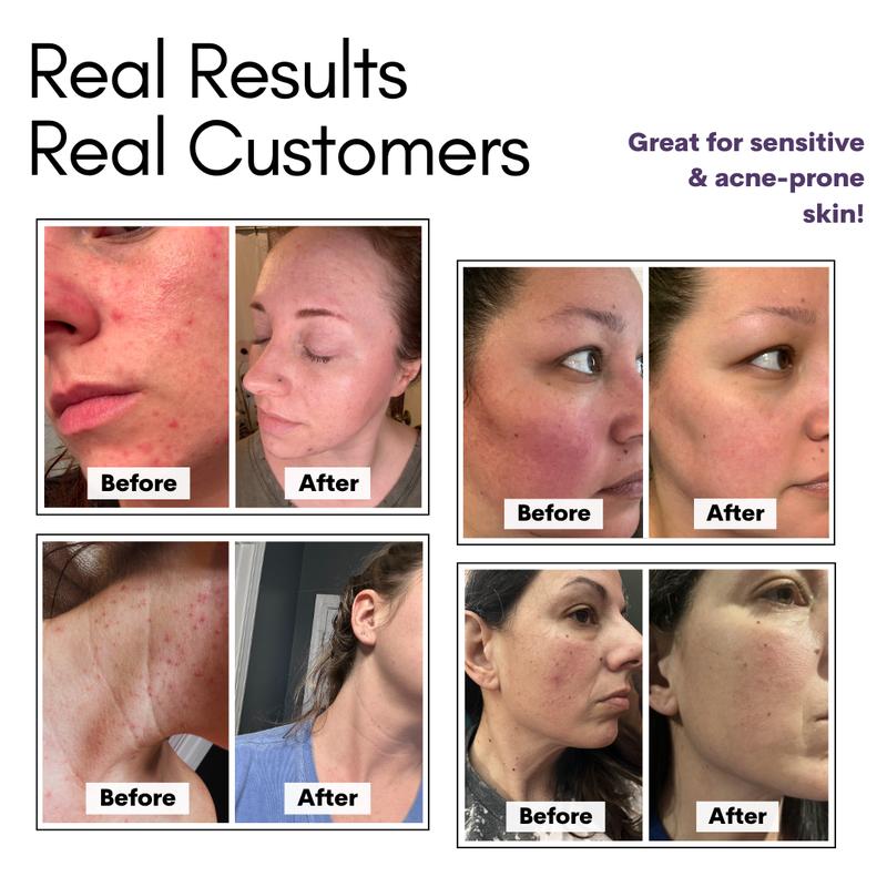 Cattle Creek's Whipped Beef Tallow Face Cream with Frankincense, Myrrh & Rose – Nourishing Moisturizer, Hydrating Anti-Aging Skincare, Soothing & Repairing Daily Lotion Sensitive Smoothing