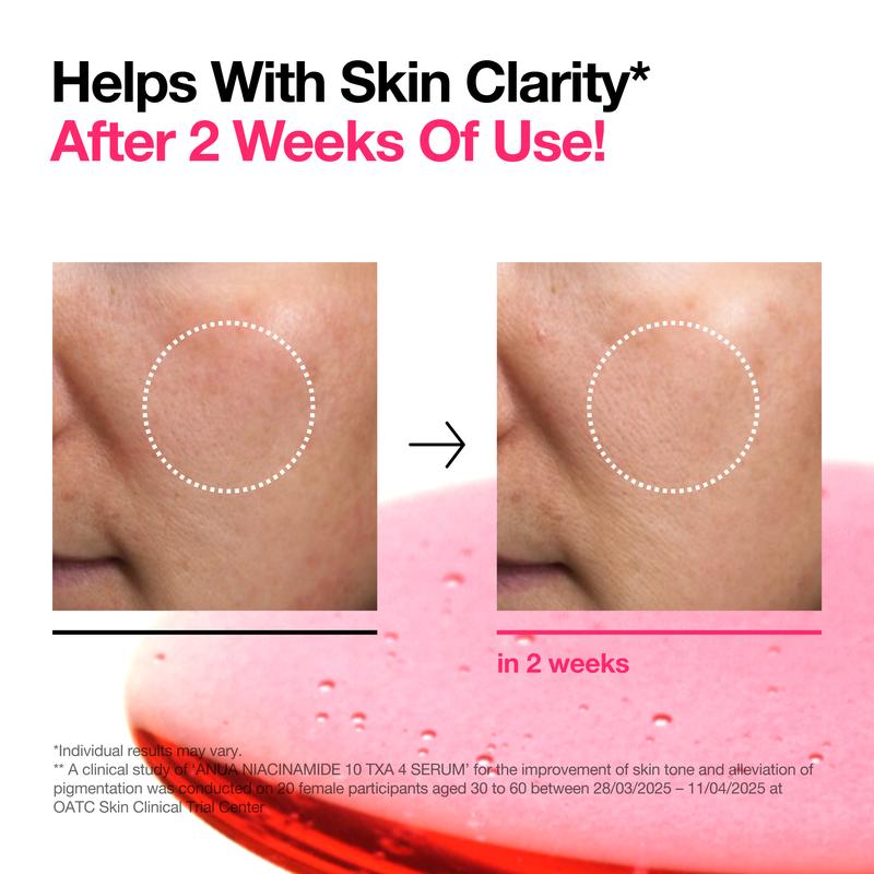 [Anua Official] Dark Spot Correcting Serum : 10% Niacinamide+ 4% Tranexamic Acid 1.01 fl.oz. (30ml) ｜ Niacinamide Serum, PM Skincare product, Hyperpigmentation, Brightening