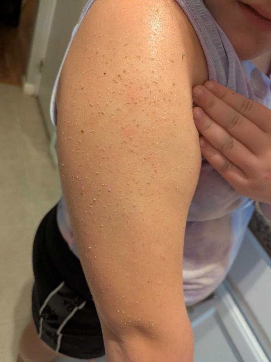 Item: Black Rice Peeling Ampoule + Body Peeling Spray