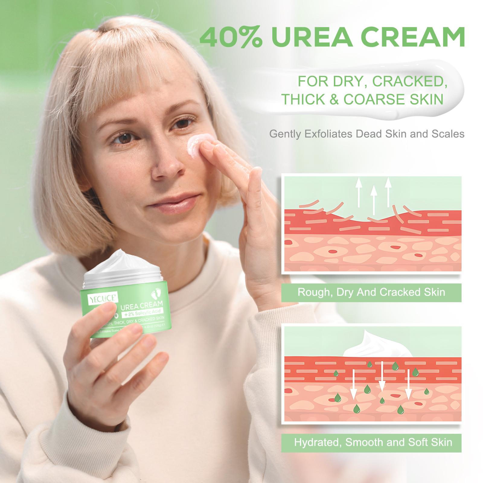Urea Cream 40% plus Salicylic Acid 2% - Maximum Strength for Dry, Cracked Feet and Hands - Moisturizes and Softens Hydrating Exfoliating Skin Friendly Moisturizer Hyaluronic Moisturizing Moisture Hydrate Nails Urea Cream 40% plus Salicylic Acid 2% - Maximum Strength for Dry, Cracked Feet and Hands - Moisturizes and Softens Hydrating Exfoliating Skin Friendly Moisturizer Hyaluronic Moisturizing Moisture Hydrate Nails