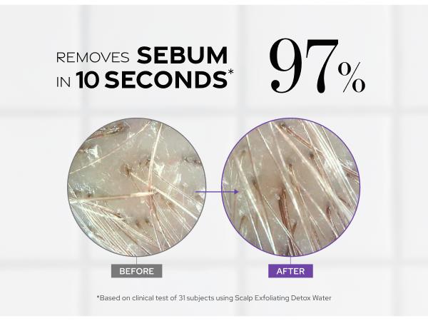 Dr. Groot Scalp Revitalizing Solution Scalp Exfoliating Detox Water - Gentle Exfoliation with AHA PHA LHA, Rosemary Oil, Menthol, Niacinamide for All Scalp Types