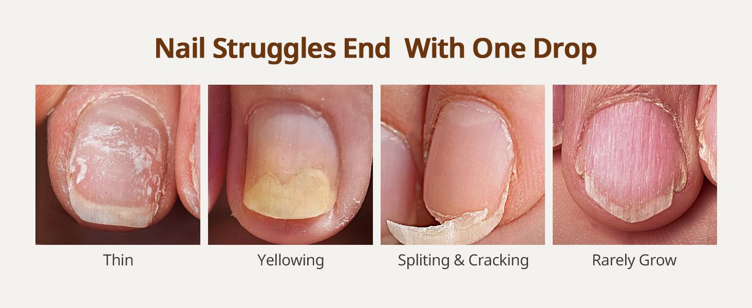 BTArtboxnails Naillush Nail Growth Oil - Nail Strengthener & Growth Repair Damaged Nails, Strengthen Weak & Thin Nails, Extra Strong Nail Growth Treatment, Long Lasting Nail Hardener, 15ml