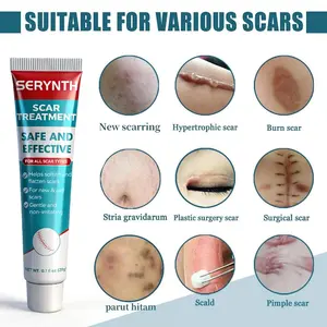 Black scab scar remover, leg scar remover, chicken pox scar remover, mosquito bite scars, old scars, keloids