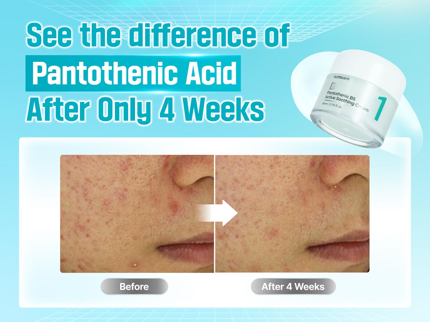 [numbuzin official shop] No.1 Cream | Pantothenic B5 Active Soothing Cream | 2.70 fl oz.