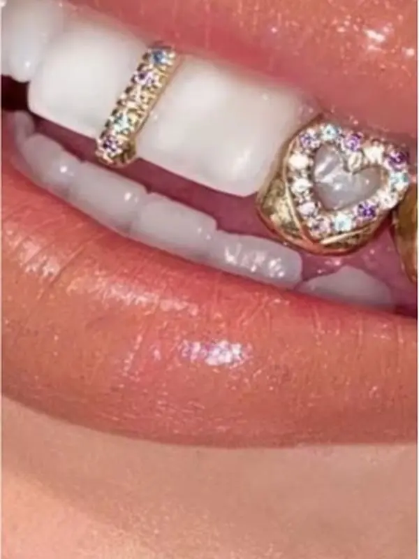 Gold  Plated Hollow Heart Grillz Teeth Jewelry – Gold  Hip Hop Snap-On Tooth Caps. Comes with two pieces  heart and bar tweezers