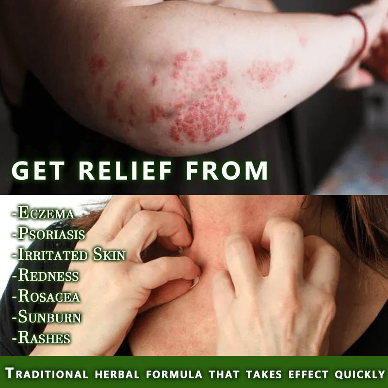 Soothing & Relief Cream for Eczema with 100% Natural Plant Extracts, Relief from Eczema & Blisters, Honeysuckle & Peppermint, Gift for Family and Friends, Gentle for All Ages, Quick-Relief Itch Soother, Moisturizes Dry & Sensitive Skin