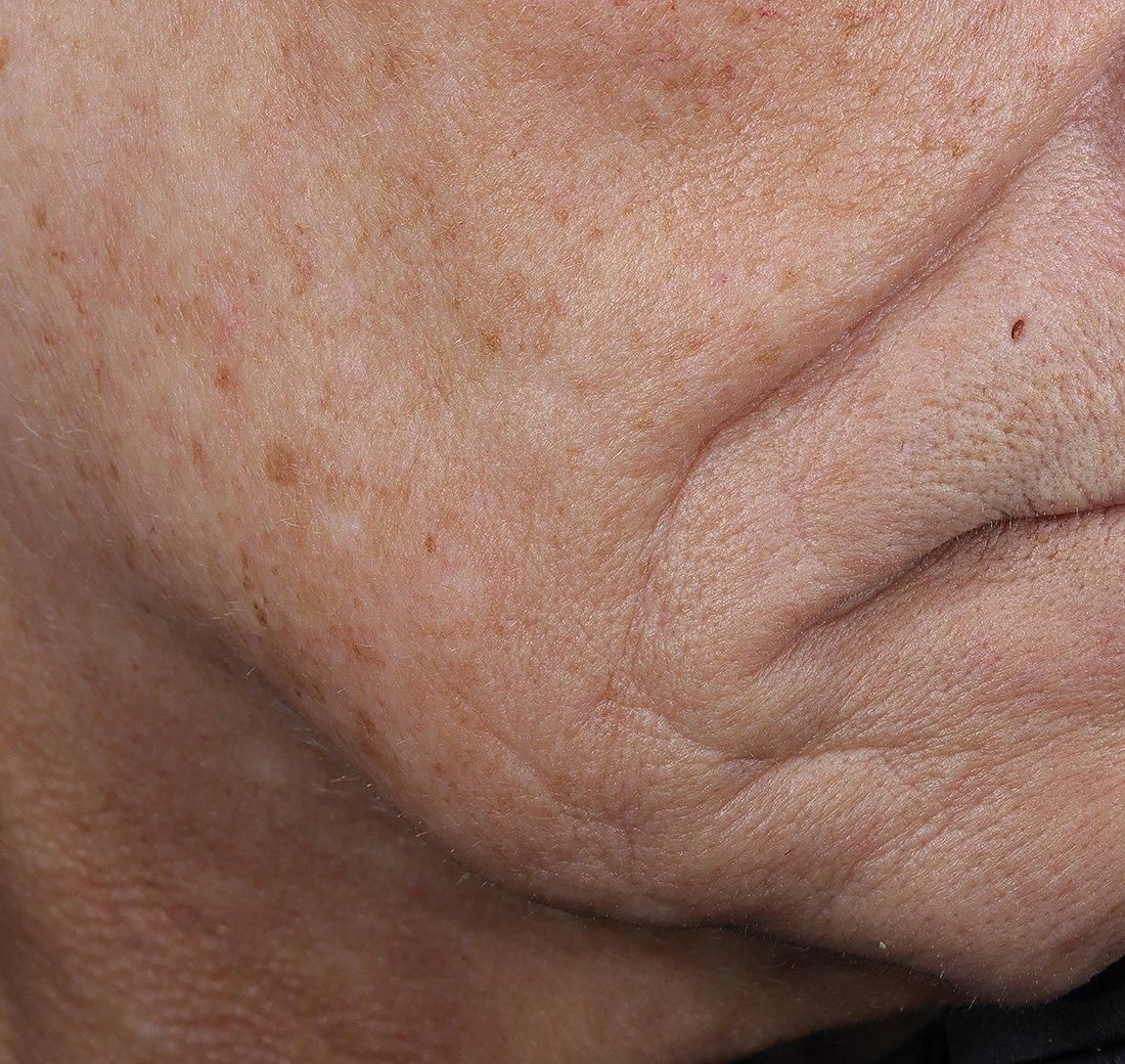 Obagi Medical ELASTIderm Lift & Sculpt Facial Moisturizer – lifts, firms, and hydrates with Bi-Mineral Complex