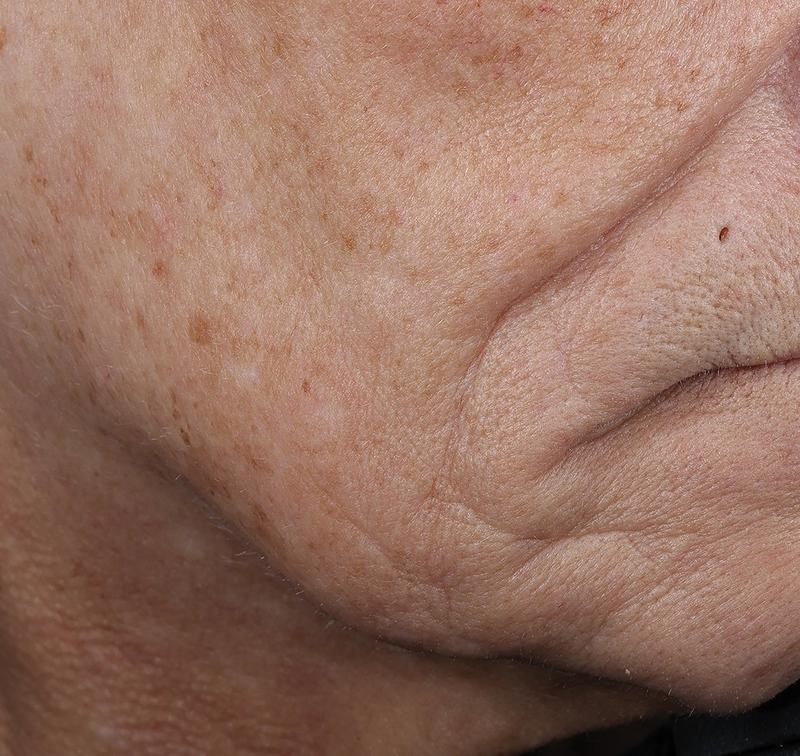 Obagi Medical ELASTIderm Lift & Sculpt Facial Moisturizer – lifts, firms, and hydrates with Bi-Mineral Complex