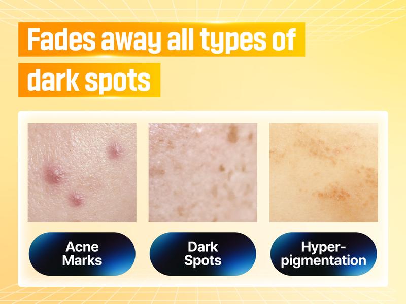 [numbuzin official shop] No.5 Serum | Vitamin Concentrated Serum | Tranexamic Acid 4%, Niacinamide 5%, Glutathione, Vitamin C | Hyperpigmentation | 1.01 fl. oz.