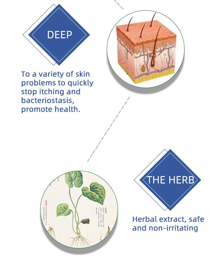 Maximum Strength Anti-Fungal Cream – Targets Psoriasis, Ringworm, Athlete’s Foot, Tinea, Eczema – 100% Plant-Based & Steroid-Free – Soothes Itch, Repairs Dry Skin, Prevents Flare-Ups Maximum Strength Anti-Fungal Cream – Targets Psoriasis, Ringworm, Athlete’s Foot, Tinea, Eczema – 100% Plant-Based & Steroid-Free – Soothes Itch, Repairs Dry Skin, Prevents Flare-Ups