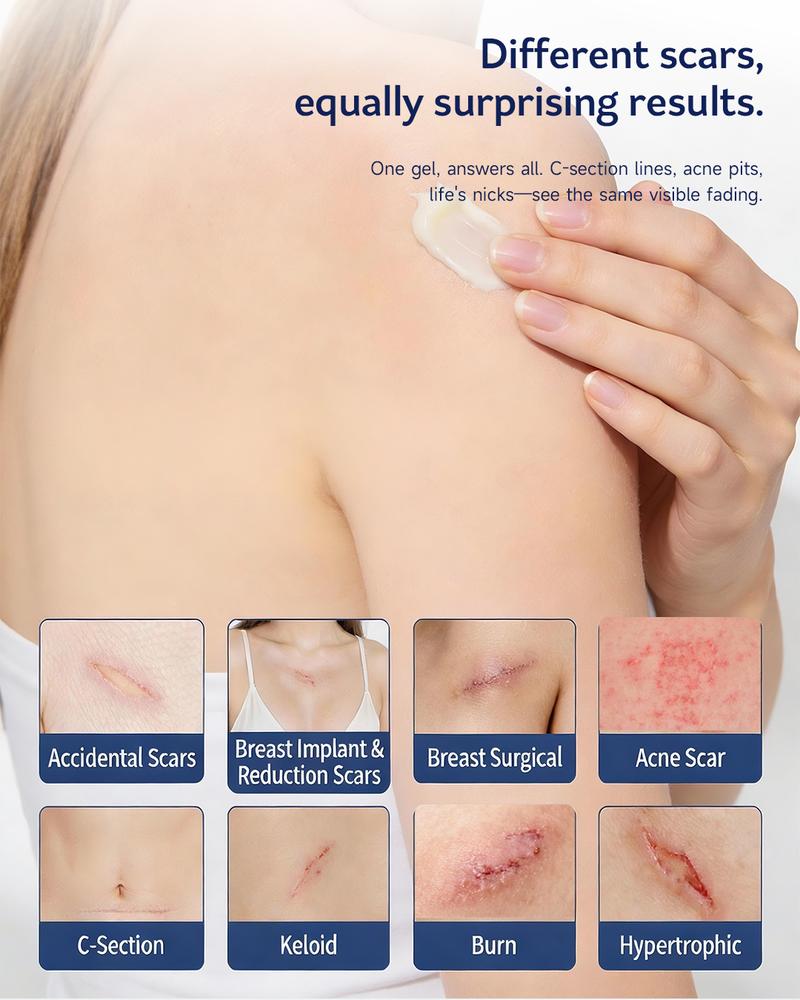 NovacaraX Medical Grade Silicone Scar Treatment Cream - Advanced Fade for Keloids C-Section Surgical Burns & Acne Marks - Safe for Adults Kids & Pregnant Women - FDA-Recommended Formula