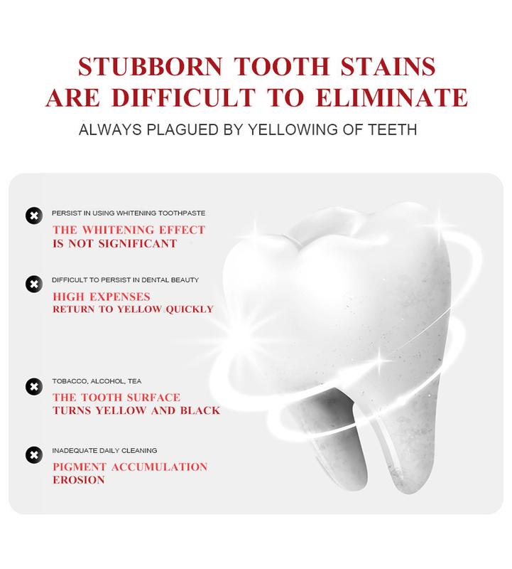 SP-7 Whitening Toothpaste with Active Probiotics Helps Fight Stains Maintain Whiteness 100g for Daily Dental Care