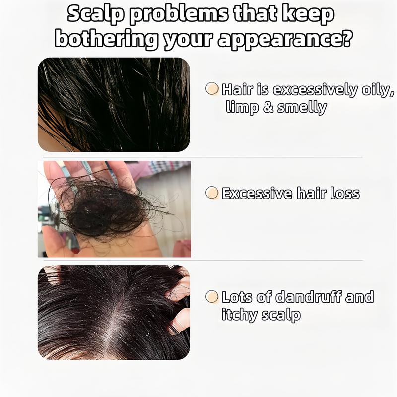 【Buy 1 Get 1 Free】REMIMPI Anti-Hair Fall Hair Loss Treatment Shampoo Oil Control Anti dandruff Haircare Ginseng Ginger Help Hair Growth Jojoba Oat Repair Reduce Hair Loss Scalp Cleanser Conditioner300ML