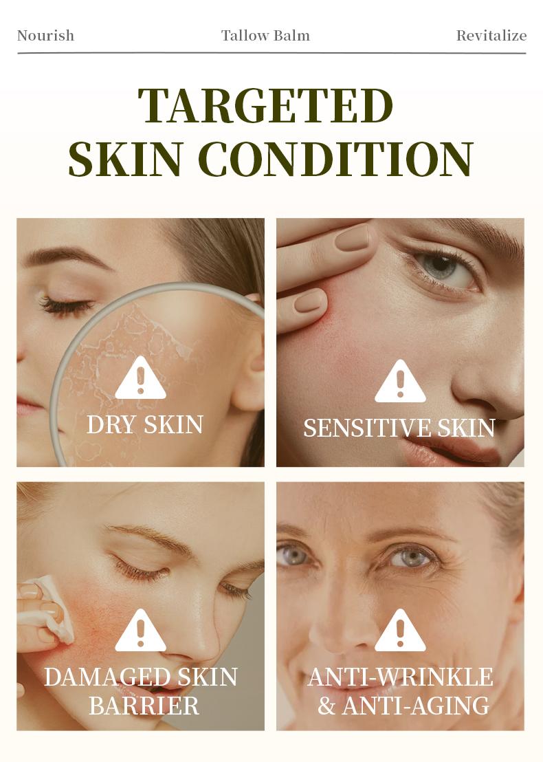 Organic Whipped Grass-Fed Beef Tallow Balm with Raw Manuka Honey – All-Natural Moisturizing Cream for Face, Body & Lips – Handmade Skin Care for Soft, Smooth & Nourished Skin – 4 Oz Jar