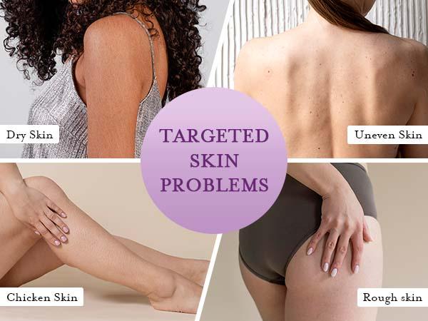 Elvira KP Bump Eraser Foot & Body Scrub, Exfoliating Scrub for Keratosis Pilaris, Smooth Skin with 10% AHA BHA & Niacinamide, Deep Moisturizing Cleanser for All Skin Types, Exfoliante para el Cuerpo